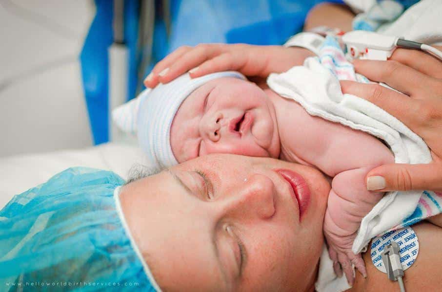 Cesareans