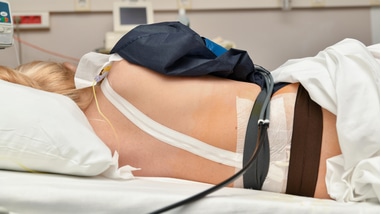 Epidurals for Birth